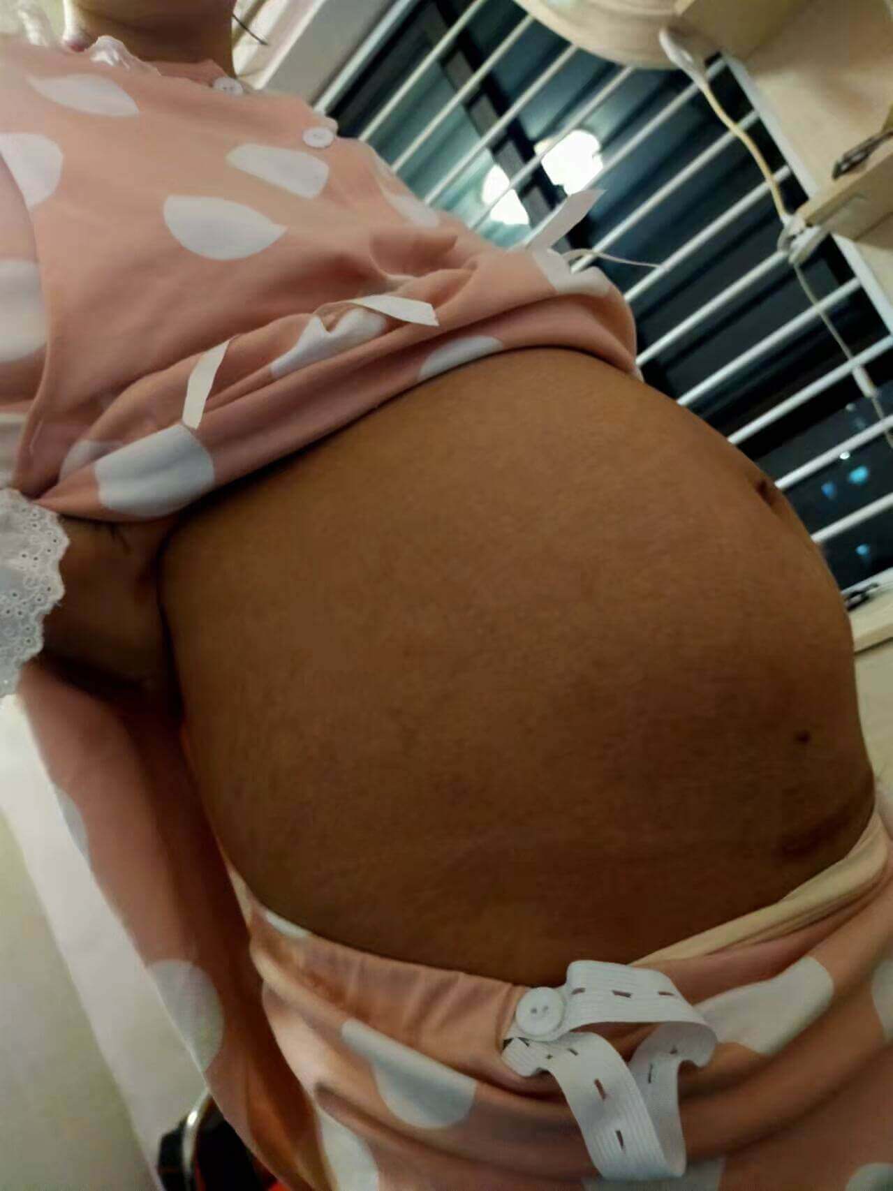 好孕連連青島客戶楊女士喜得兩位小王子